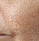 Inflammaging 101: What Is Inflammaging and How to Stop Inflammation Aging